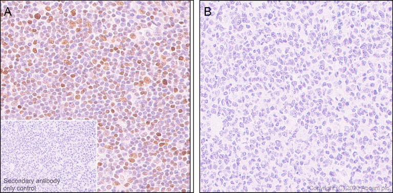 Immunohistochemistry (Formalin/PFA-fixed paraffin-embedded sections) - Anti-STAT3 (phospho Y705) antibody [EPR23968-52] - BSA and Azide free (AB280202)