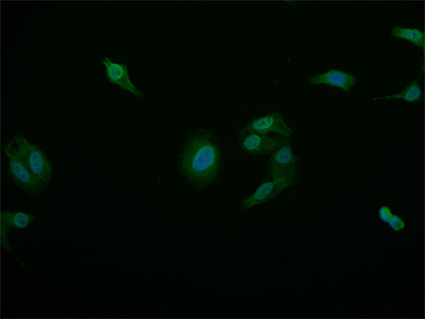 Immunocytochemistry/ Immunofluorescence - Anti-STAT4 antibody [26G2] (AB314181), expandable thumbnail