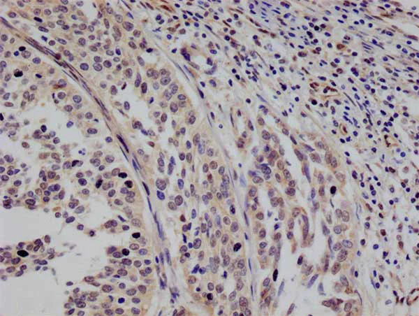 Immunohistochemistry (Formalin/PFA-fixed paraffin-embedded sections) - Anti-STAT4 antibody [26G2] (AB314181)