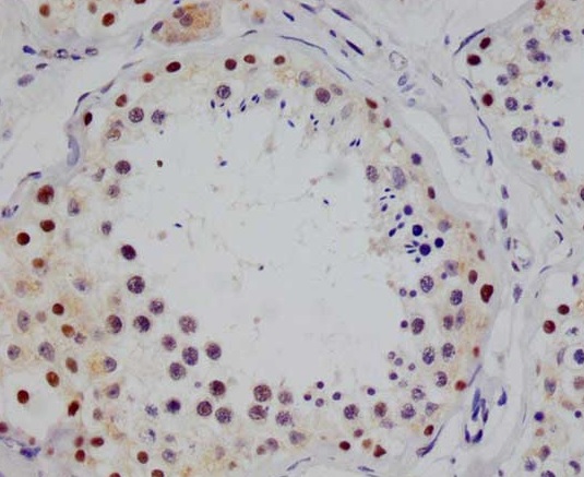 Immunohistochemistry (Formalin/PFA-fixed paraffin-embedded sections) - Anti-STAT4 antibody [26G2] (AB314181), expandable thumbnail