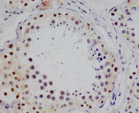 Immunohistochemistry (Formalin/PFA-fixed paraffin-embedded sections) - Anti-STAT4 antibody [26G2] (AB314181)