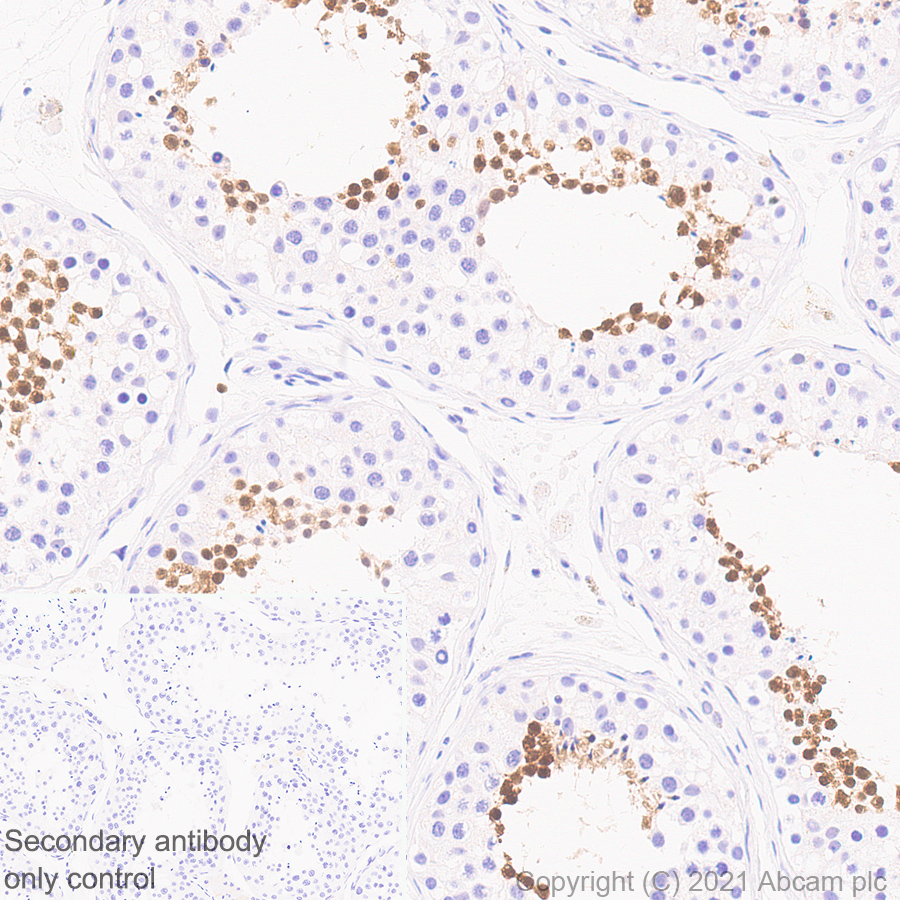 Immunohistochemistry (Formalin/PFA-fixed paraffin-embedded sections) - Anti-STAT4 antibody [EPR25128-48] (ab284408), expandable thumbnail