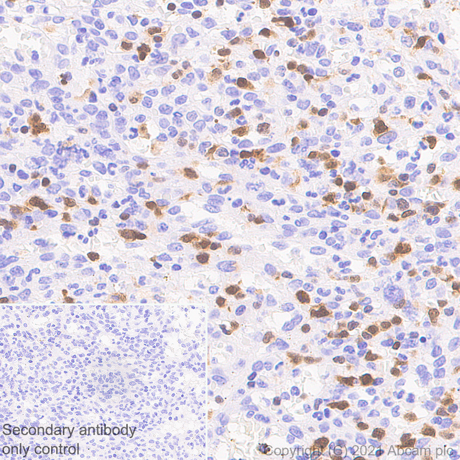Immunohistochemistry (Formalin/PFA-fixed paraffin-embedded sections) - Anti-STAT4 antibody [EPR25128-48] (ab284408), expandable thumbnail