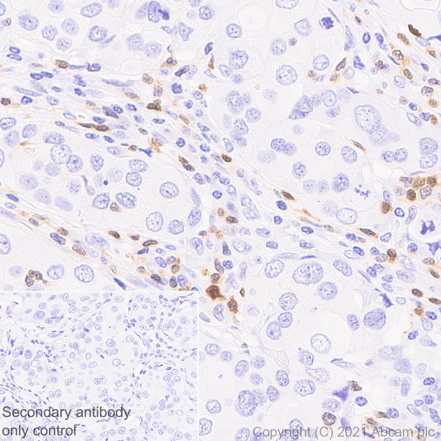 Immunohistochemistry (Formalin/PFA-fixed paraffin-embedded sections) - Anti-STAT4 antibody [EPR25128-48] (ab284408), expandable thumbnail