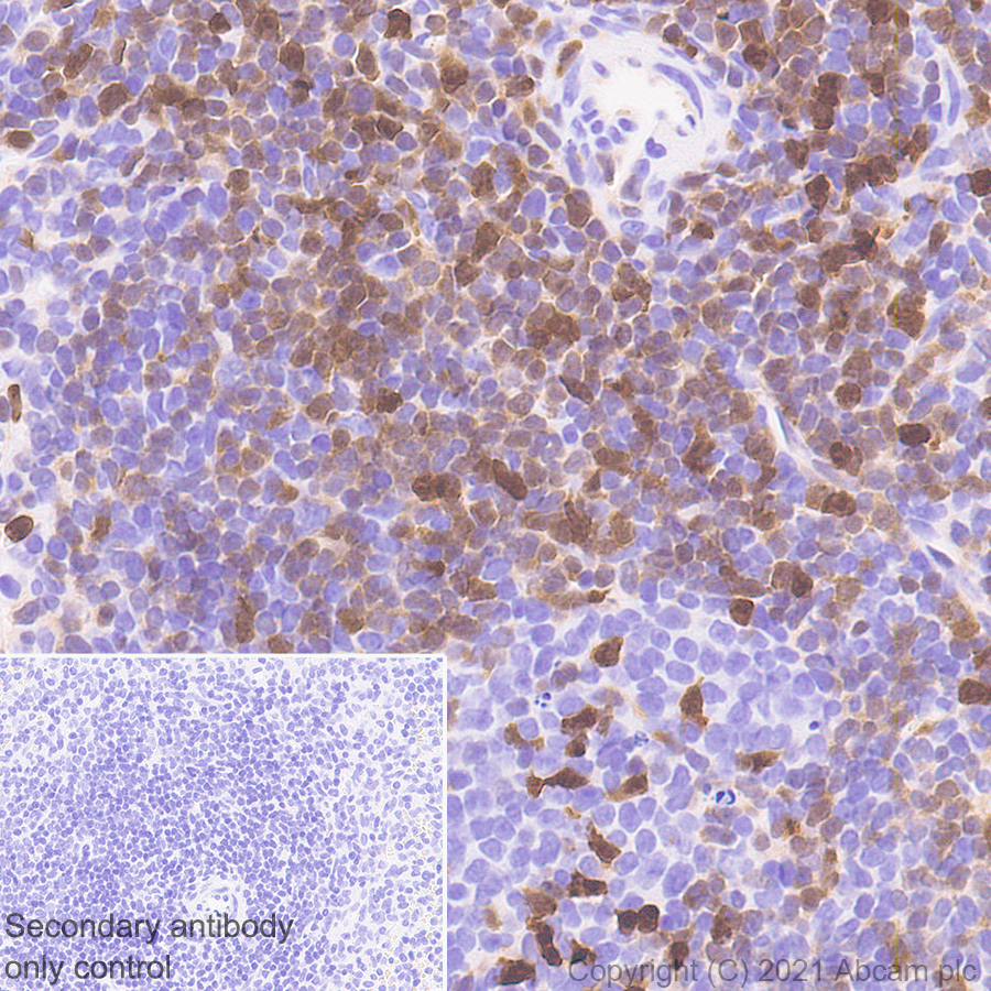 Immunohistochemistry (Formalin/PFA-fixed paraffin-embedded sections) - Anti-STAT4 antibody [EPR25128-48] (ab284408), expandable thumbnail