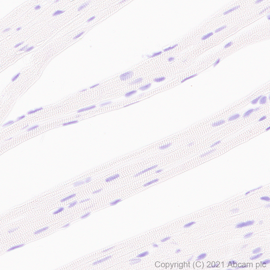 Immunohistochemistry (Formalin/PFA-fixed paraffin-embedded sections) - Anti-STAT4 antibody [EPR25128-48] (ab284408), expandable thumbnail