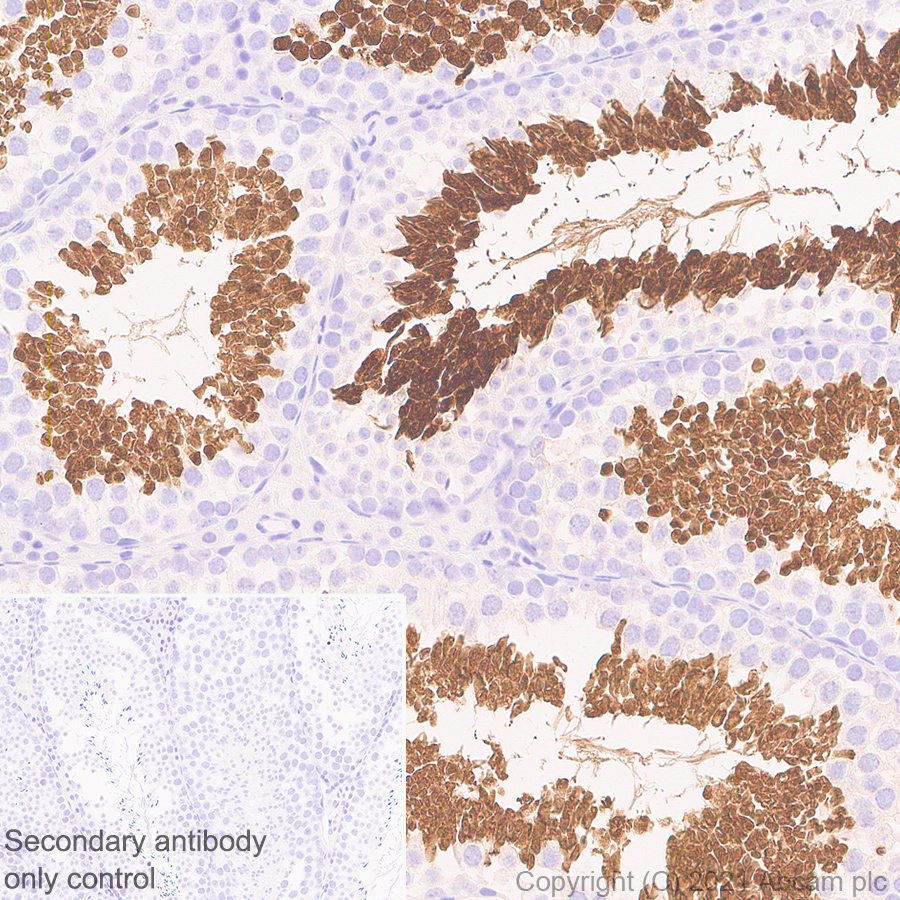 Immunohistochemistry (Formalin/PFA-fixed paraffin-embedded sections) - Anti-STAT4 antibody [EPR25128-48] (ab284408), expandable thumbnail