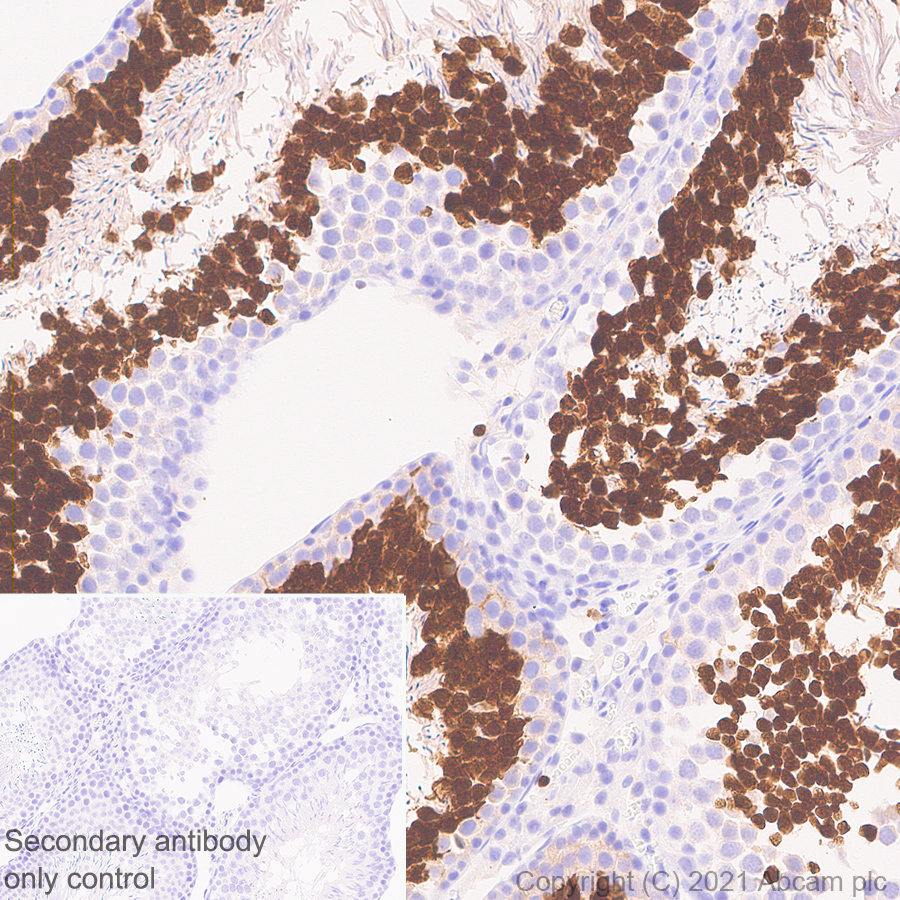 Immunohistochemistry (Formalin/PFA-fixed paraffin-embedded sections) - Anti-STAT4 antibody [EPR25128-48] (AB284408), expandable thumbnail
