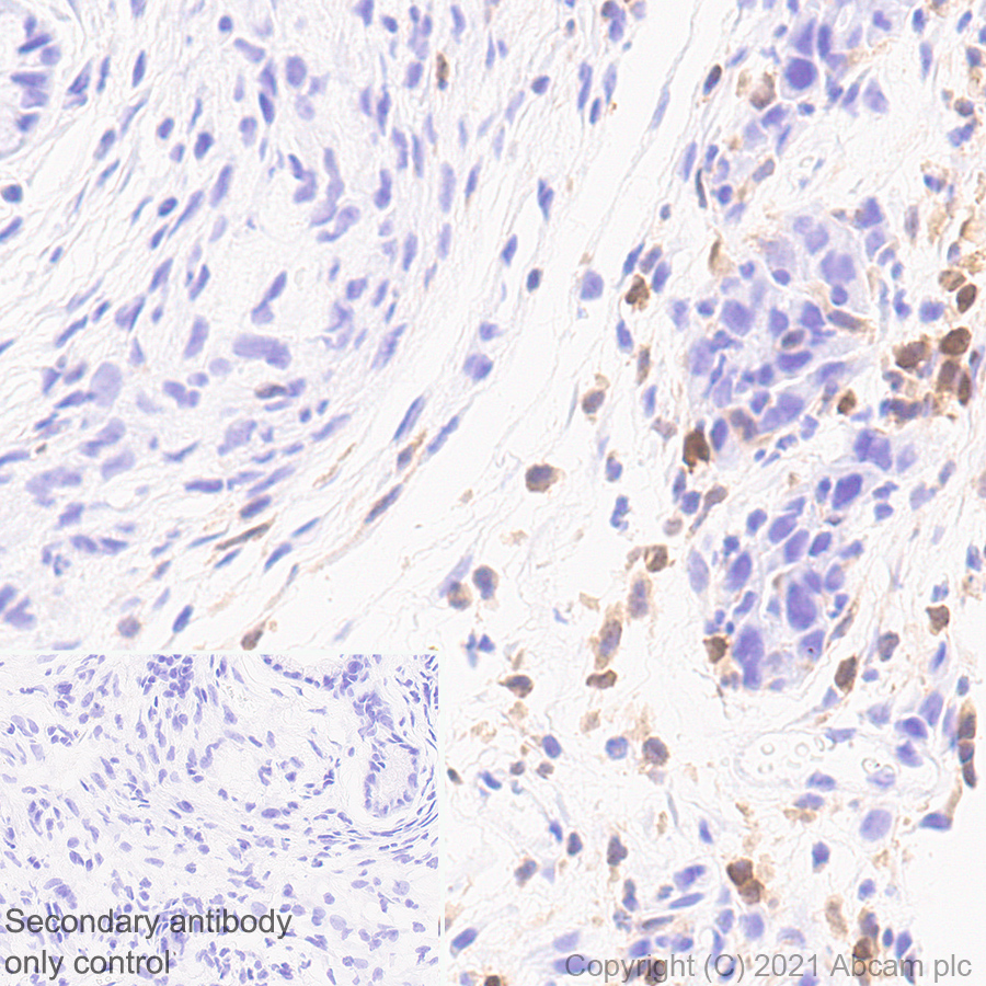 Immunohistochemistry (Formalin/PFA-fixed paraffin-embedded sections) - Anti-STAT4 antibody [EPR25128-48] (ab284408), expandable thumbnail