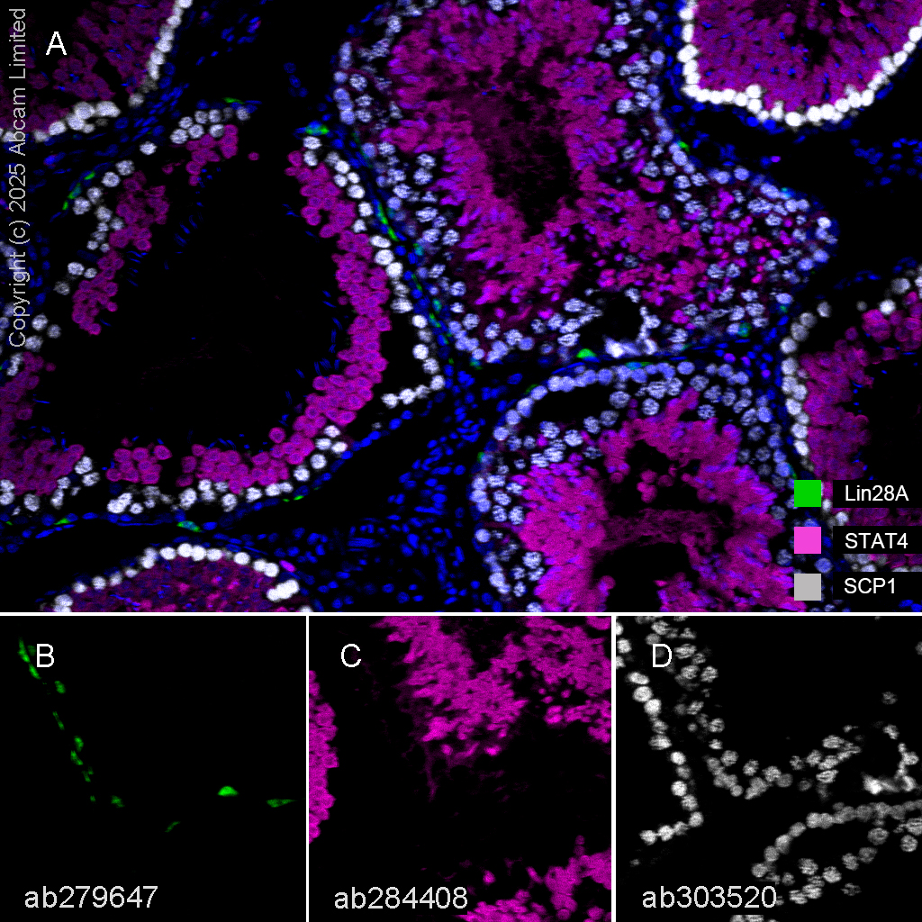 Multiplex immunohistochemistry - Anti-STAT4 antibody [EPR25128-48] (AB284408)