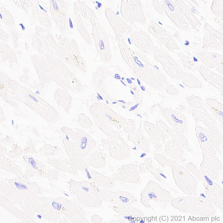 Immunohistochemistry (Formalin/PFA-fixed paraffin-embedded sections) - Anti-STAT4 antibody [EPR25128-48] - BSA and Azide free (AB284412)