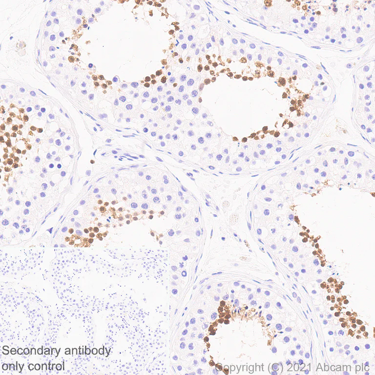 Immunohistochemistry (Formalin/PFA-fixed paraffin-embedded sections) - Anti-STAT4 antibody [EPR25128-48] - BSA and Azide free (AB284412)