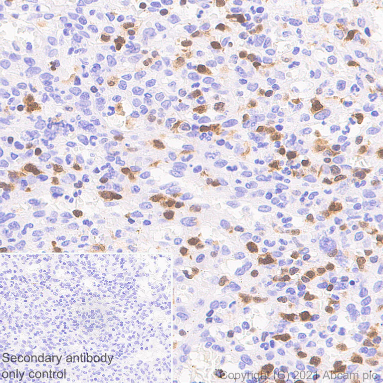 Immunohistochemistry (Formalin/PFA-fixed paraffin-embedded sections) - Anti-STAT4 antibody [EPR25128-48] - BSA and Azide free (AB284412)