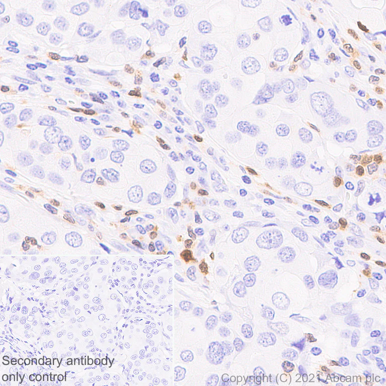 Immunohistochemistry (Formalin/PFA-fixed paraffin-embedded sections) - Anti-STAT4 antibody [EPR25128-48] - BSA and Azide free (AB284412)