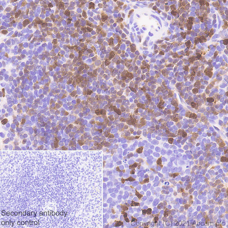 Immunohistochemistry (Formalin/PFA-fixed paraffin-embedded sections) - Anti-STAT4 antibody [EPR25128-48] - BSA and Azide free (AB284412)
