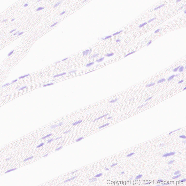 Immunohistochemistry (Formalin/PFA-fixed paraffin-embedded sections) - Anti-STAT4 antibody [EPR25128-48] - BSA and Azide free (AB284412)
