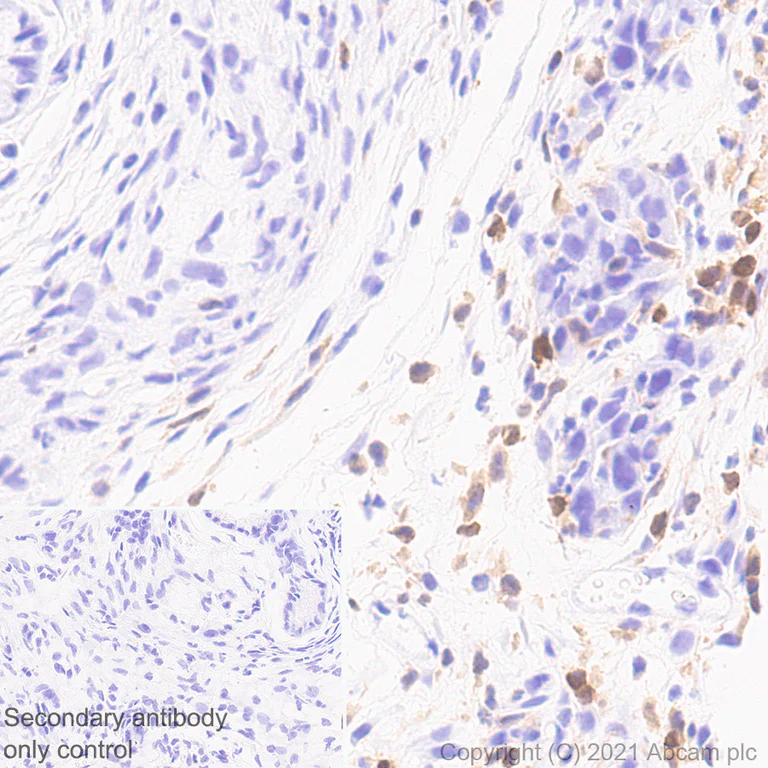 Immunohistochemistry (Formalin/PFA-fixed paraffin-embedded sections) - Anti-STAT4 antibody [EPR25128-48] - BSA and Azide free (AB284412)