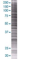 SDS-PAGE - STAT4 overexpression 293T lysate (whole cell) (AB94123), expandable thumbnail