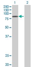 Western blot - STAT4 overexpression 293T lysate (whole cell) (AB94123), expandable thumbnail
