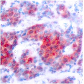 Immunohistochemistry (Formalin/PFA-fixed paraffin-embedded sections) - Anti-STAT4 (phospho Y693) antibody (AB194732)