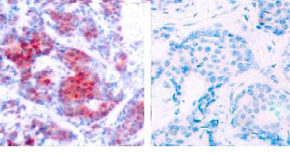 Immunohistochemistry (Formalin/PFA-fixed paraffin-embedded sections) - Anti-STAT4 (phospho Y693) antibody (AB28815)