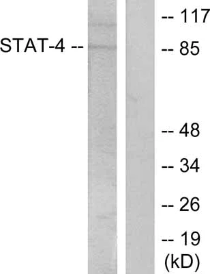 Western blot - Anti-STAT4 (phospho Y693) antibody (AB28815)