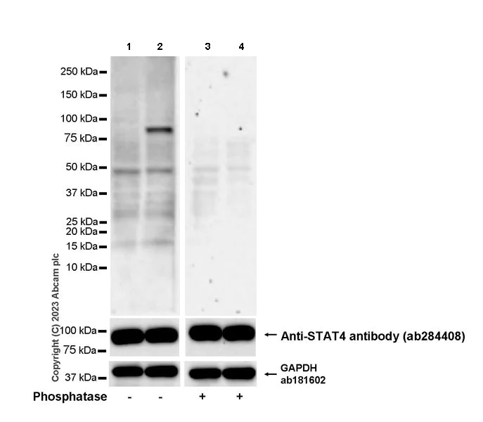 Western blot - Anti-STAT4 (phospho Y693) antibody [EPR27081-49] - BSA and Azide free (AB313631)