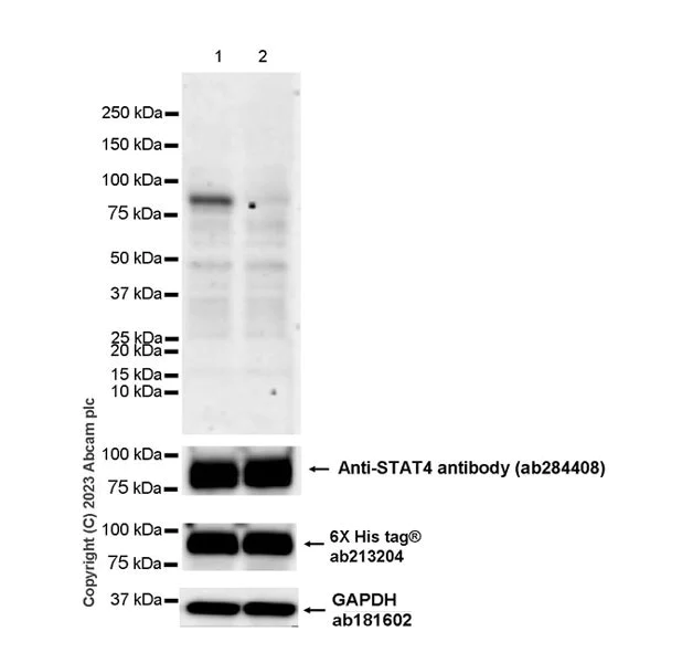 Western blot - Anti-STAT4 (phospho Y693) antibody [EPR27081-49] - BSA and Azide free (AB313631)