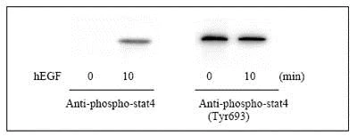 Western blot - STAT4 (Tyr693) In-Cell ELISA Kit (AB126428)