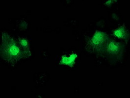 Immunocytochemistry/ Immunofluorescence - Anti-STAT5 antibody [9F7] (AB230670), expandable thumbnail