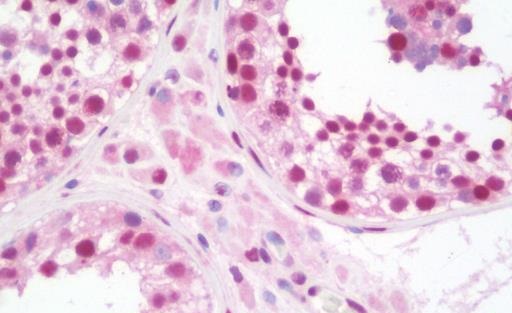 Immunohistochemistry (Formalin/PFA-fixed paraffin-embedded sections) - Anti-STAT5 antibody [9F7] (AB230670), expandable thumbnail