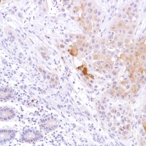 Immunohistochemistry (Formalin/PFA-fixed paraffin-embedded sections) - Anti-STAT5 antibody [SP283] - BSA and Azide free (ab272013), expandable thumbnail