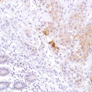 Immunohistochemistry (Formalin/PFA-fixed paraffin-embedded sections) - Anti-STAT5 antibody [SP283] - BSA and Azide free (AB272013)