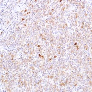 Immunohistochemistry (Formalin/PFA-fixed paraffin-embedded sections) - Anti-STAT5 antibody [SP283] - BSA and Azide free (AB272013)