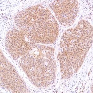 Immunohistochemistry (Formalin/PFA-fixed paraffin-embedded sections) - Anti-STAT5 antibody [SP283] - BSA and Azide free (AB272013), expandable thumbnail