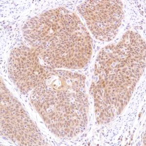 Immunohistochemistry (Formalin/PFA-fixed paraffin-embedded sections) - Anti-STAT5 antibody [SP283] - BSA and Azide free (AB272013)