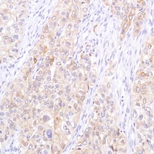 Immunohistochemistry (Formalin/PFA-fixed paraffin-embedded sections) - Anti-STAT5 antibody [SP283] - BSA and Azide free (ab272013), expandable thumbnail