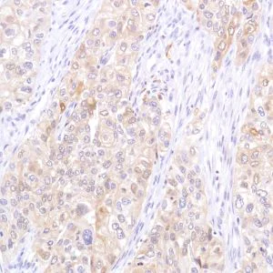 Immunohistochemistry (Formalin/PFA-fixed paraffin-embedded sections) - Anti-STAT5 antibody [SP283] - BSA and Azide free (AB272013)