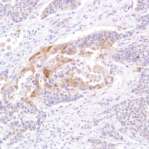 Immunohistochemistry (Formalin/PFA-fixed paraffin-embedded sections) - Anti-STAT5 antibody [SP283] - BSA and Azide free (AB272013), expandable thumbnail
