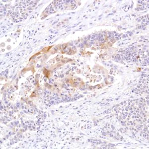 Immunohistochemistry (Formalin/PFA-fixed paraffin-embedded sections) - Anti-STAT5 antibody [SP283] - BSA and Azide free (AB272013)