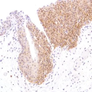 Immunohistochemistry (Formalin/PFA-fixed paraffin-embedded sections) - Anti-STAT5 antibody [SP283] - BSA and Azide free (AB272013)