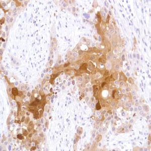 Immunohistochemistry (Formalin/PFA-fixed paraffin-embedded sections) - Anti-STAT5 antibody [SP283] - BSA and Azide free (AB272013)