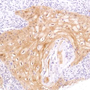 Immunohistochemistry (Formalin/PFA-fixed paraffin-embedded sections) - Anti-STAT5 antibody [SP283] - BSA and Azide free (AB272013)