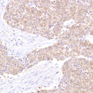 Immunohistochemistry (Formalin/PFA-fixed paraffin-embedded sections) - Anti-STAT5 antibody [SP283] - BSA and Azide free (AB272013)