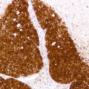 Immunohistochemistry (Formalin/PFA-fixed paraffin-embedded sections) - Anti-STAT5 antibody [SP283] - BSA and Azide free (ab272013), expandable thumbnail