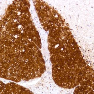 Immunohistochemistry (Formalin/PFA-fixed paraffin-embedded sections) - Anti-STAT5 antibody [SP283] - BSA and Azide free (AB272013)