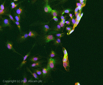 Immunocytochemistry/ Immunofluorescence - Anti-STAT5 (phospho Y694) antibody (AB98338)