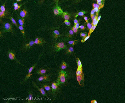 Immunocytochemistry/ Immunofluorescence - Anti-STAT5 (phospho Y694) antibody (AB98338)