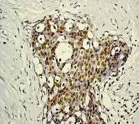 Immunohistochemistry (Formalin/PFA-fixed paraffin-embedded sections) - Anti-STAT5 (phospho Y694) antibody [E208] - BSA and Azide free (AB219607), expandable thumbnail