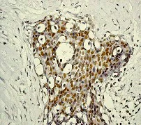 Immunohistochemistry (Formalin/PFA-fixed paraffin-embedded sections) - Anti-STAT5 (phospho Y694) antibody [E208] - BSA and Azide free (AB219607)
